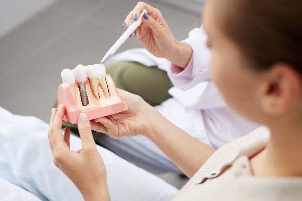 osteointegrazione su modello di impianto dentale