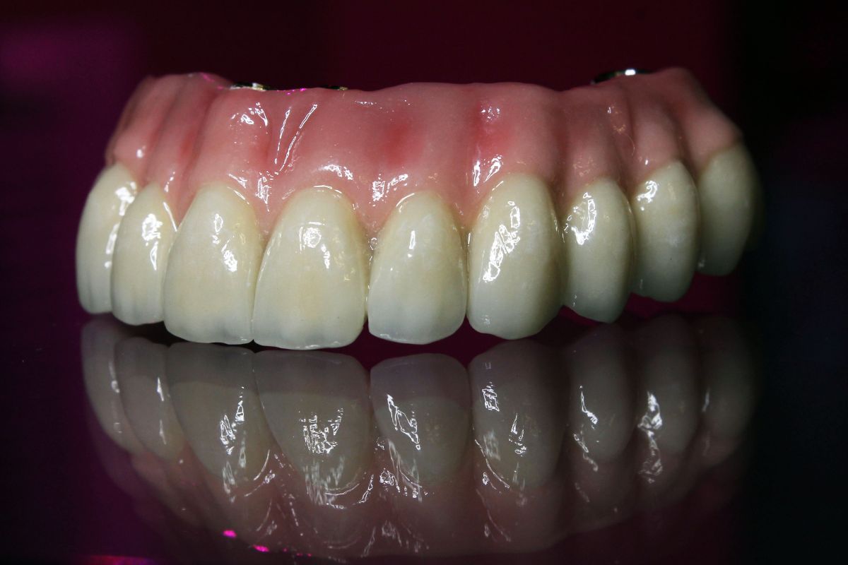 impianto dentale in zirconia