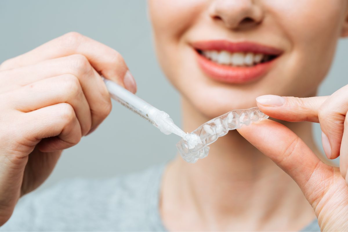 inserimento gel per mascherina con sbiancamento dentale