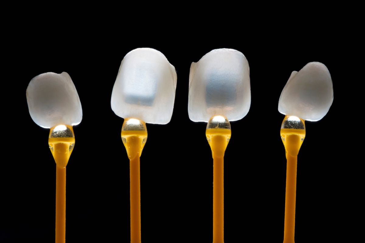 tipi di faccette dentali su appositi sostegni
