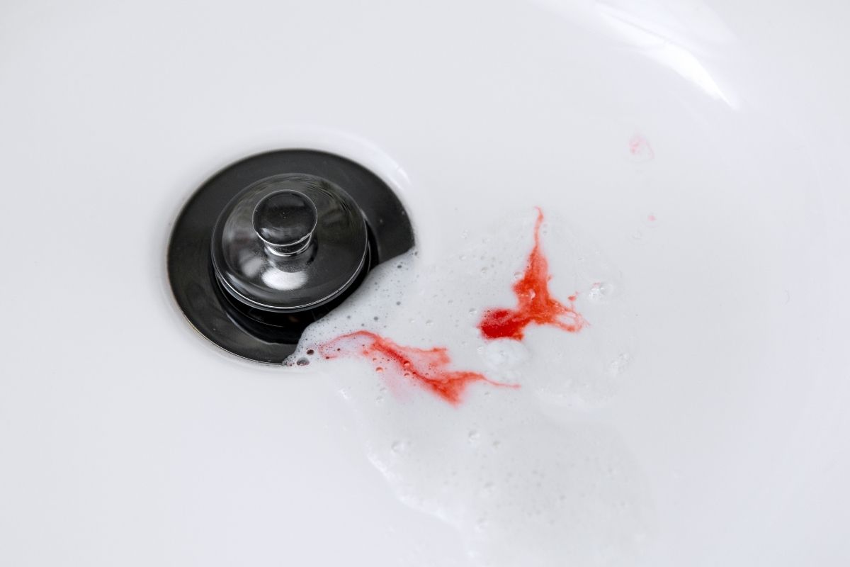 sangue derivante dallo spazzolamento dei denti, possibile segnale di una infezione all'impianto dentale