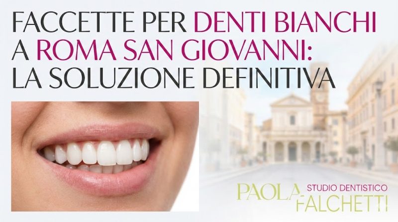copertina faccette per denti bianchi