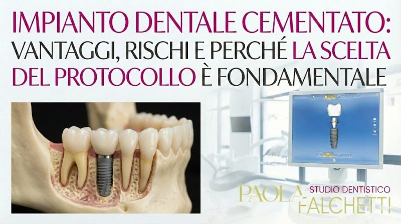 copertina articolo impianto dentale cementato